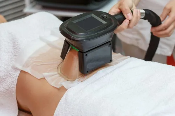 Image of person having fat freezing treatment to help weight gain Thame