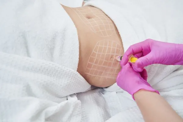 image of fat dissolving injections on love handles to help combat weight gain Thame