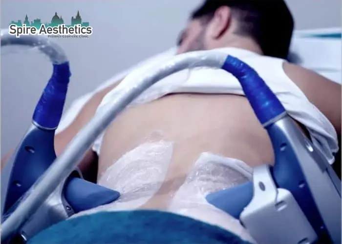 Man having fat freezing treatment done on love handles before a competitions Thame to create a sculpted look.