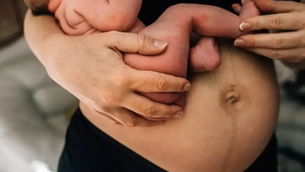 Why Is My Stomach Still Big After Pregnancy Thame?